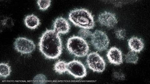 صورة مجهرية لفيروس كورونا المسبب لمرض "كوفيد-19"