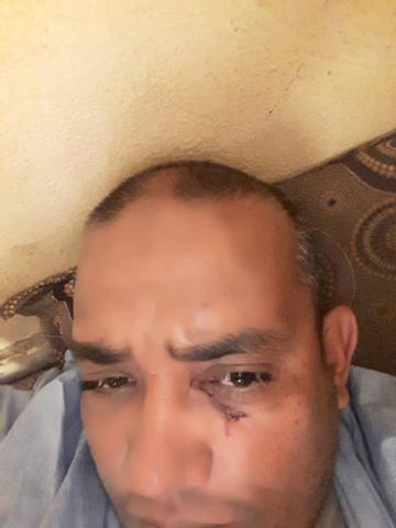 صورة رئيس المصلحة الذي تبدو عليه آثار الاعتداء